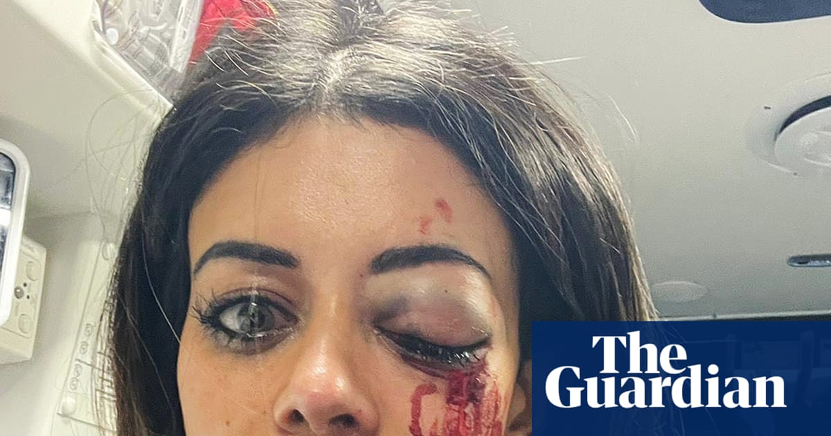 Police officer charged with assault after Hannah Thomas injured at pro-Palestine protest in Sydney | New South Wales