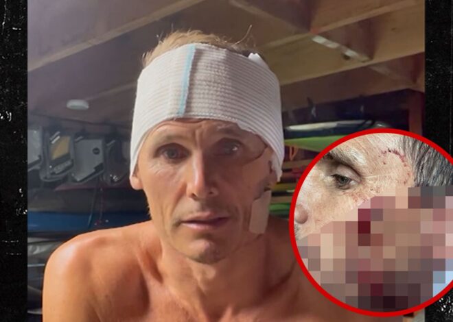 Surfer Jamie Mitchell Suffers Gruesome Cuts in Freak Wipeout