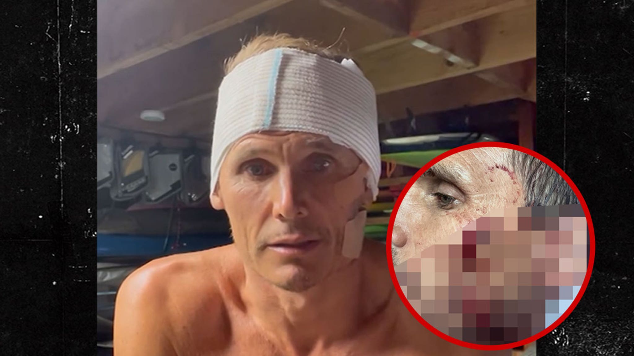 Surfer Jamie Mitchell Suffers Gruesome Cuts in Freak Wipeout