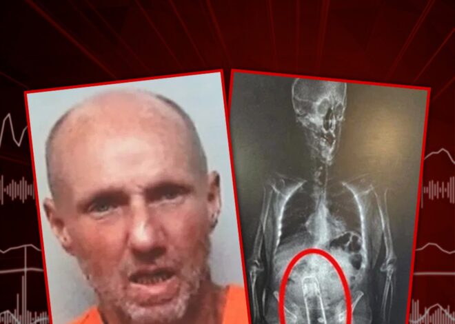 Florida Man Caught With Thermos Up His Rectum, Arrest X-Ray Shows