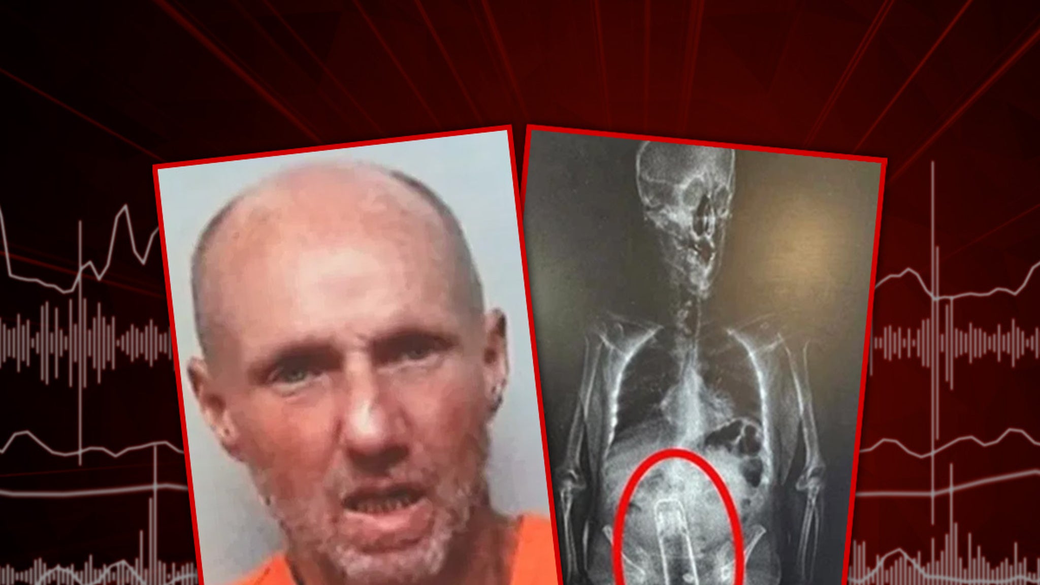 Florida Man Caught With Thermos Up His Rectum, Arrest X-Ray Shows
