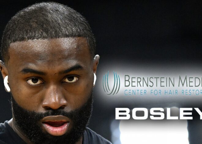 Jaylen Brown Flooded With Hair Transplant Offers, Let Us Help You!