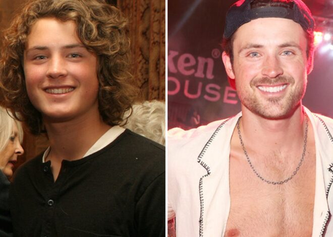 Dylan Efron Good Genes or Good Docs?!