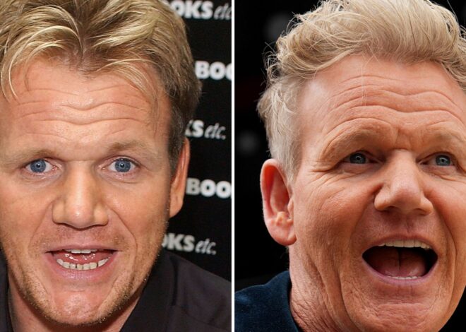 Gordon Ramsay Good Genes or Good Docs?!
