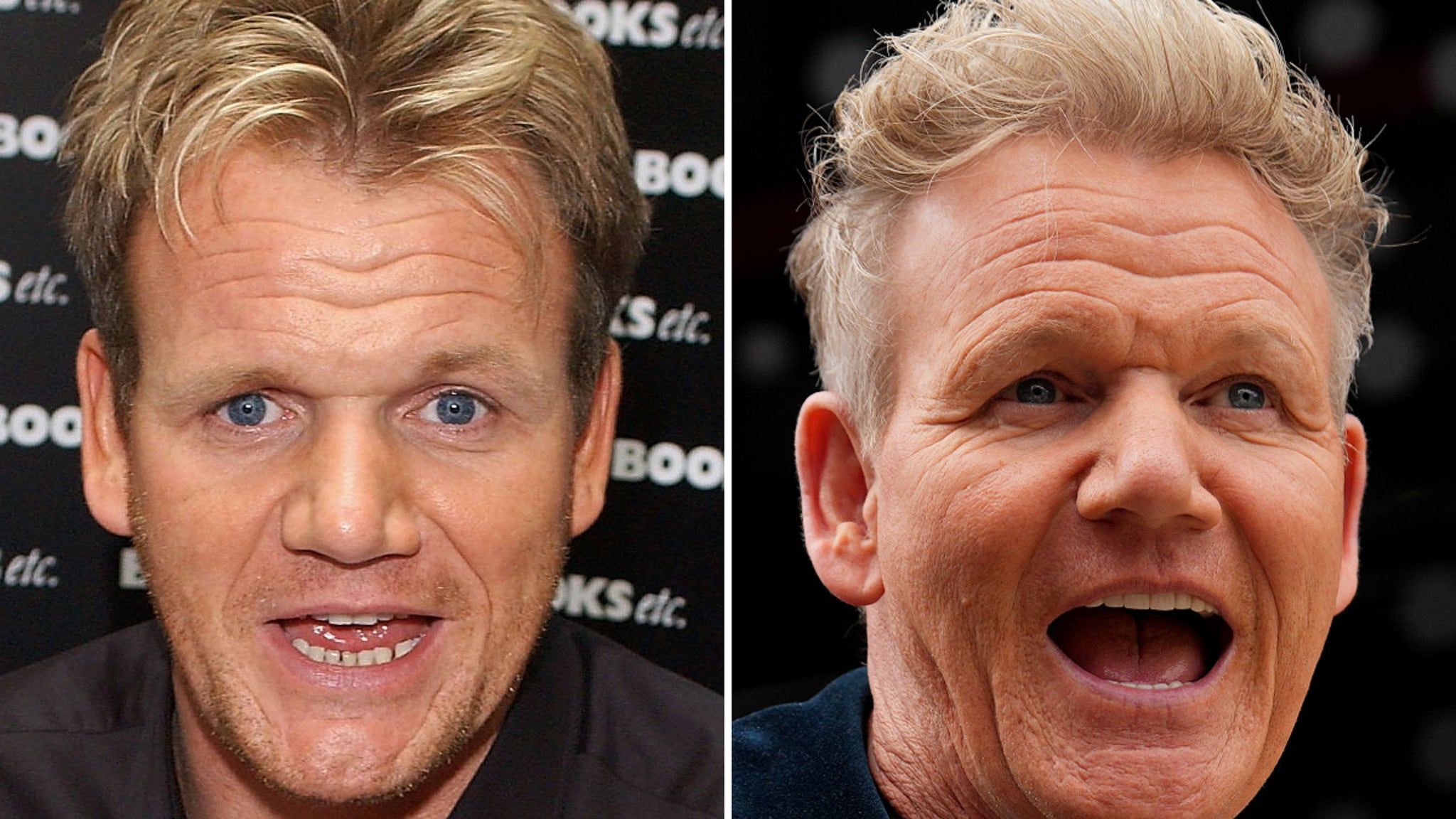 Gordon Ramsay Good Genes or Good Docs?!