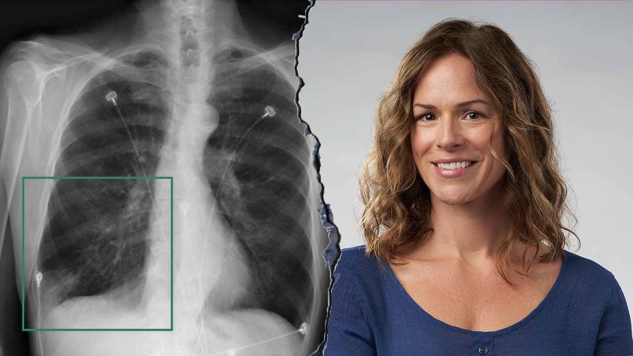 How Nvidia’s AI robots are reshaping modern medicine